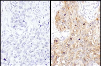 Rabbit anti-ADE2 Antibody