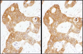 ADE2 Antibody