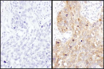 Rabbit anti-ADE2 Antibody