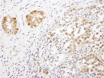 Rabbit anti-TRAX Antibody
