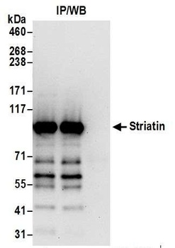 Rabbit anti-Striatin Antibody