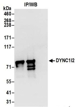 DYNC1I2 Antibody
