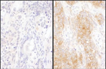 Rabbit anti-DYNC1I2 Antibody