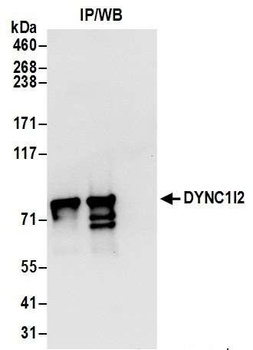 Rabbit anti-DYNC1I2 Antibody
