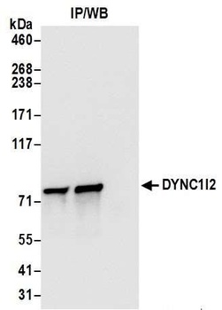 DYNC1I2 Antibody