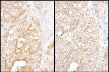 Rabbit anti-DYNC1I2 Antibody