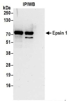 Rabbit Epsin 1 Antibody