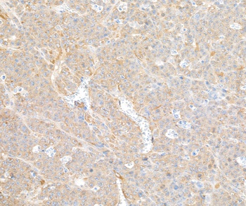 COPB2 Antibody