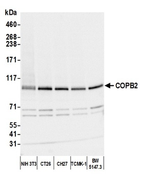 Rabbit anti-COPB2 Antibody