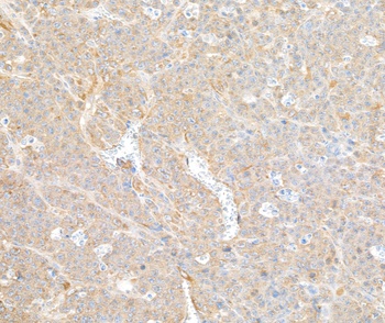 Rabbit anti-COPB2 Antibody