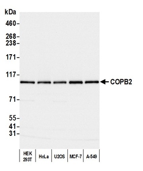 Rabbit anti-COPB2 Antibody