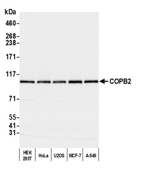 COPB2 Antibody