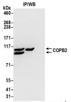 Rabbit anti-COPB2 Antibody