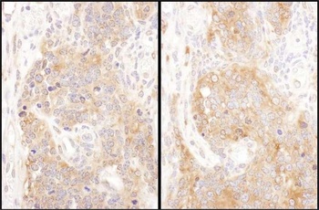 Rabbit anti-COPB2 Antibody