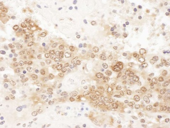 Rabbit anti-ICLN Antibody