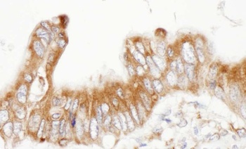 Rabbit anti-ERp5 Antibody