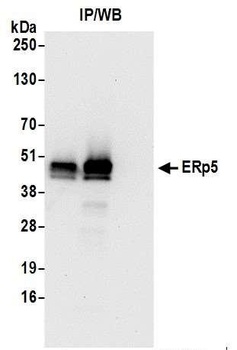 ERp5 Antibody