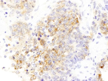 Rabbit anti-Drebrin Antibody
