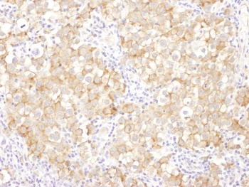 Rabbit anti-Drebrin Antibody