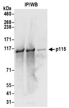 p115 Antibody