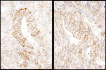 Rabbit anti-AE2 Antibody