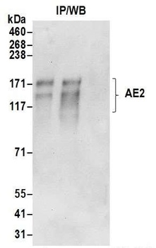 AE2 Antibody