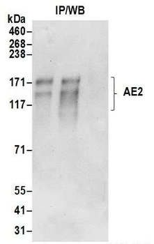 Rabbit anti-AE2 Antibody