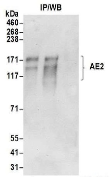 Rabbit anti-AE2 Antibody