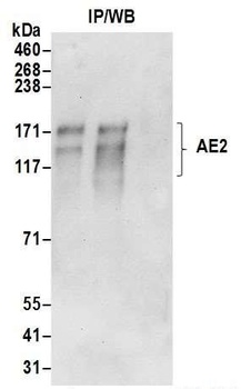 AE2 Antibody