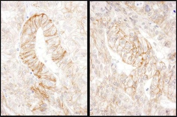 Rabbit anti-AE2 Antibody