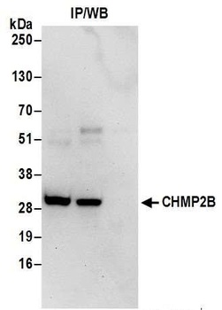 Rabbit CHMP2B Antibody