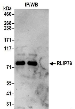 RLIP76 Antibody