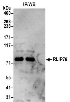 Rabbit RLIP76 Antibody
