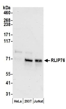 Rabbit RLIP76 Antibody