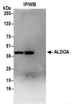 ALDOA Antibody