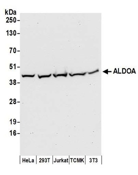 Rabbit ALDOA Antibody