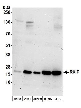 Rabbit RKIP Antibody