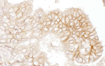 Rabbit CD147 Antibody