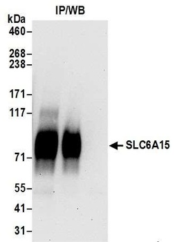 SLC6A15 Antibody