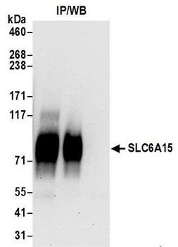 Rabbit anti-SLC6A15 Antibody