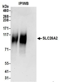 Rabbit anti-SLC26A2 Antibody