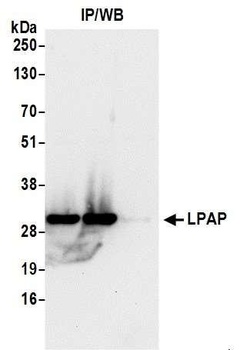 Rabbit anti-LPAP Antibody
