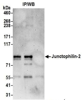 Junctophilin-2 Antibody