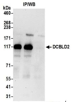 DCBLD2 Antibody