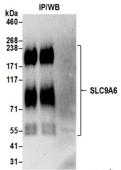 Rabbit anti-SLC9A6 Antibody