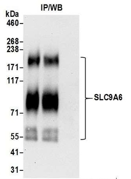 Rabbit anti-SLC9A6 Antibody