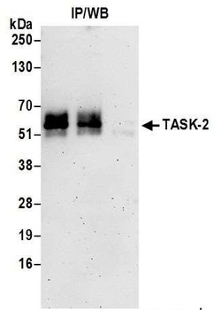 Rabbit anti-TASK-2 Antibody