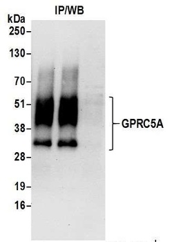 GPRC5A Antibody