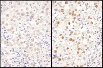 Rabbit anti-LAS1L Antibody
