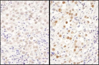 LAS1L Antibody